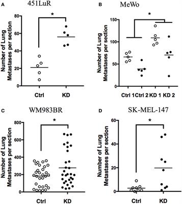 The Adhesion G-Protein-Coupled Receptor, GPR56/ADGRG1, Inhibits Cell–Extracellular Matrix Signaling to Prevent Metastatic Melanoma Growth